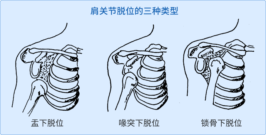 病因与分类